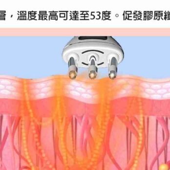 Bennlife usb充電式多功能磁叉00003