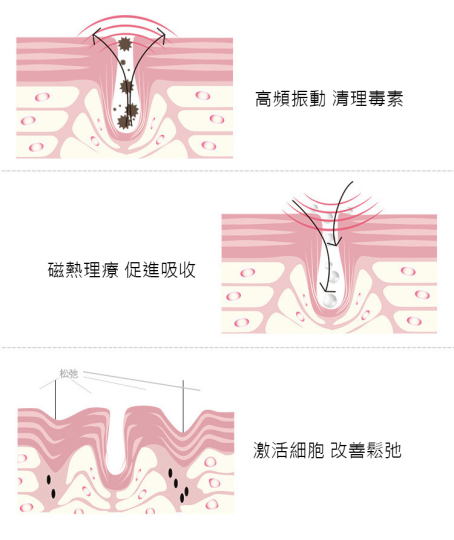 Bennlife 無線充電 眼紋淡化 温熱震動 眼唇美容儀 - Image 3